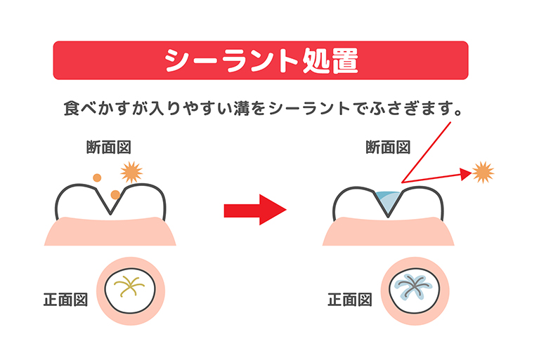 小児歯科・小児矯正